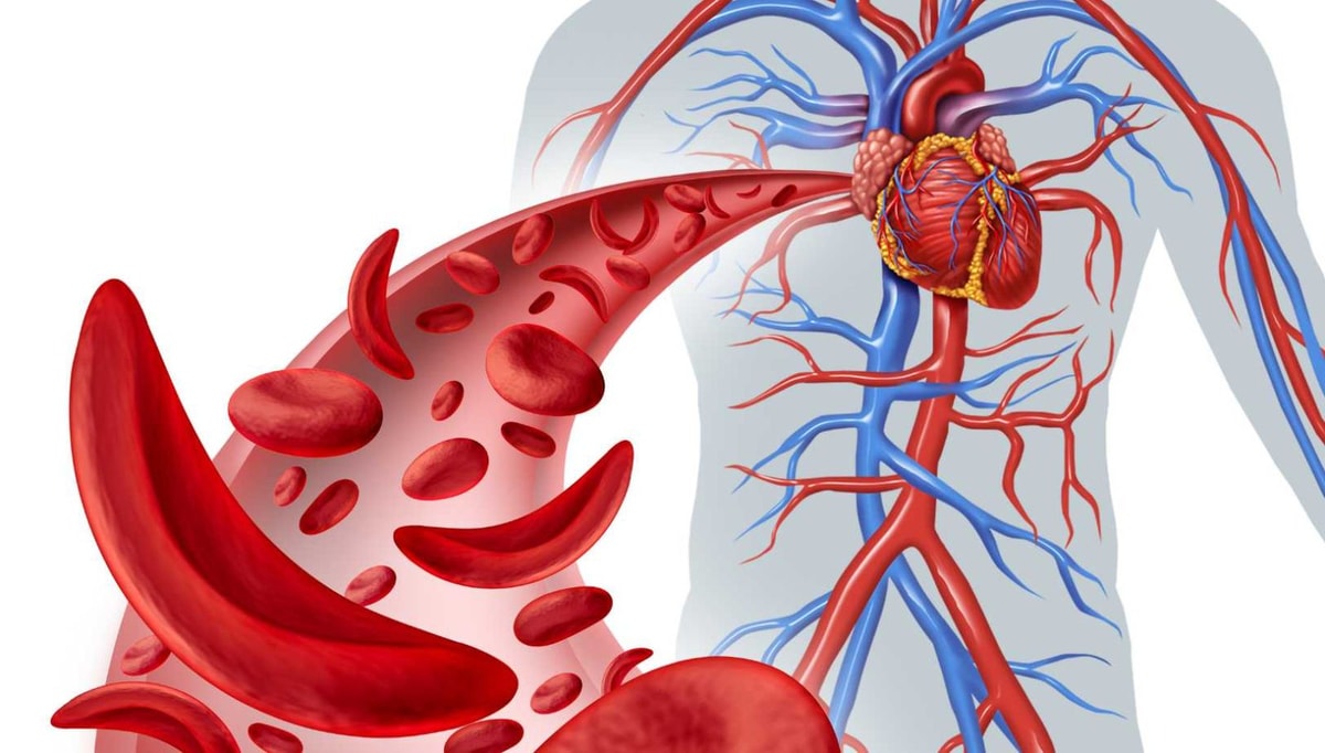 Jus détox maison : la recette de grand-mère pour une circulation sanguine au top