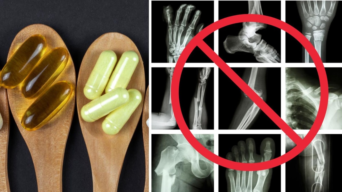 -78% de risque de fracture avec ce duo de vitamines
