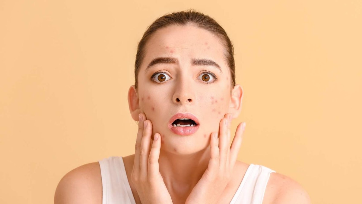 Peau grasse, acné, chute de cheveux... Et si le zinc était votre solution miracle ?