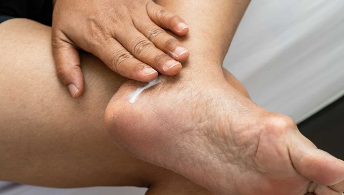 Adieu talons fendillés : 5 astuces incroyables pour des pieds de bébé