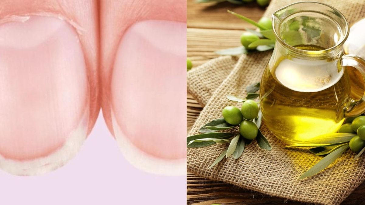 Remèdes de grand-mère contre les ongles dédoublés : retrouvez des ongles sains et solides