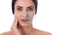 J'ai alterné ces 3 actifs pendant un mois et mes taches ont diminué de 65%