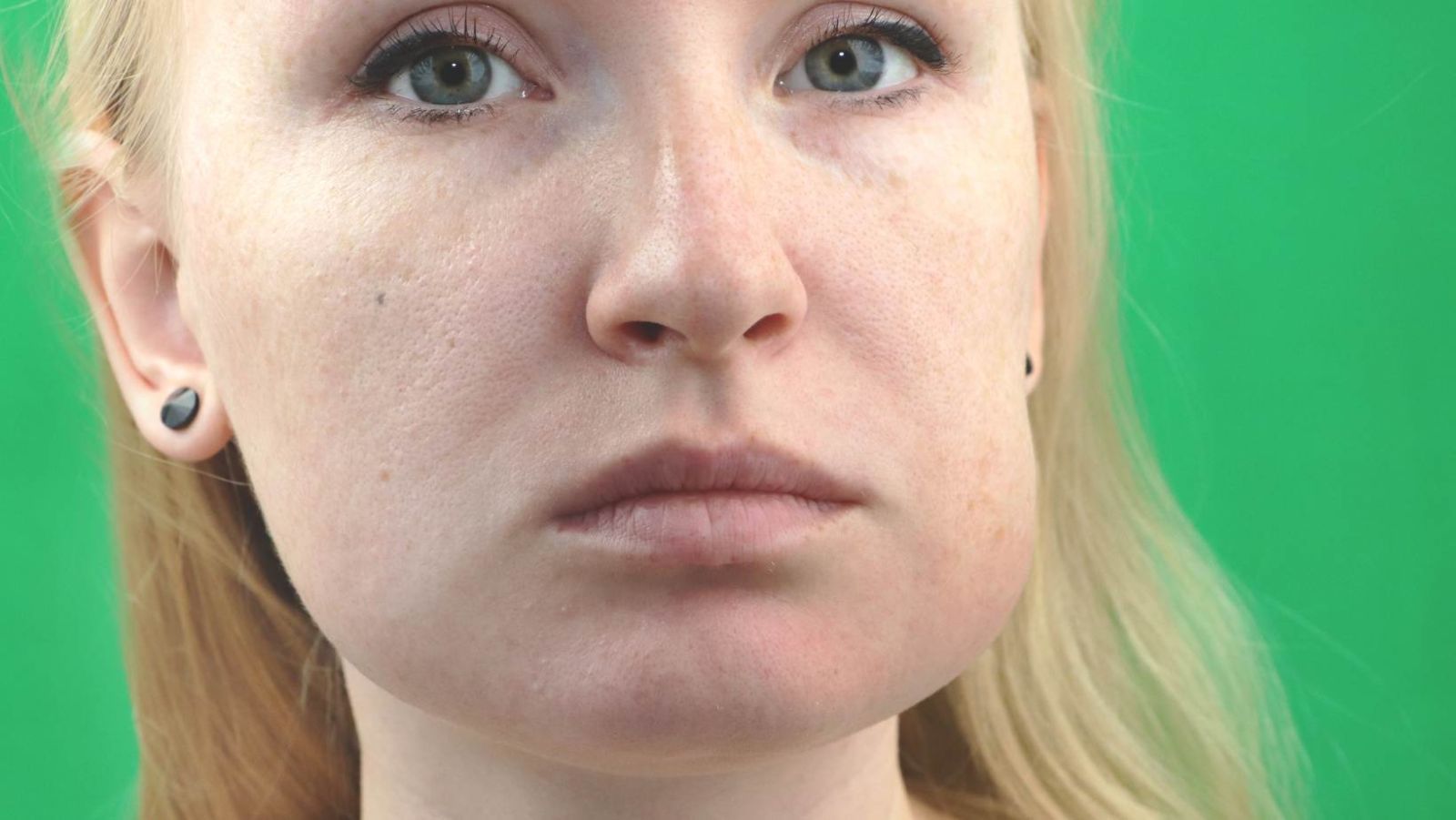 elfbar nachfüll pod läuft aus Homme avec gonflement du visage souffrant de maux Photo Stock