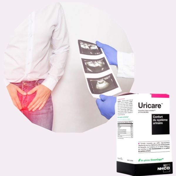 uricare avis